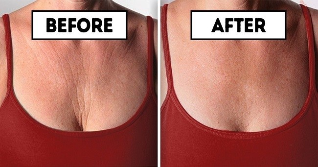 These 15 Easy And Simple Tips Can Help You Get Rid Of Chest Wrinkles Quickly