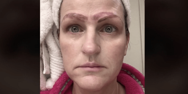 Single Mother Is Left With Four Eyebrows After Botched Microblading Treatment