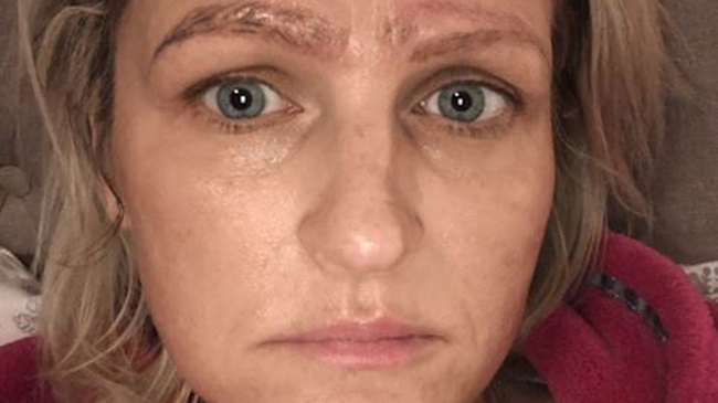 Single Mother Is Left With Four Eyebrows After Botched Microblading Treatment